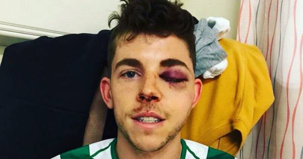 Celtic star Ryan Christie admits eyesight fears after horror injury