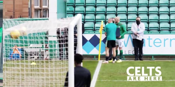 Classy Hibs Make Brilliant Celtic Gesture