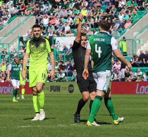 Celtic Must End Easter Road Hoodoo This Wednesday