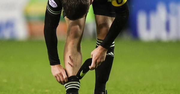 Ryan Porteous tackle leaves Celtic captain Callum McGregor with nasty wound