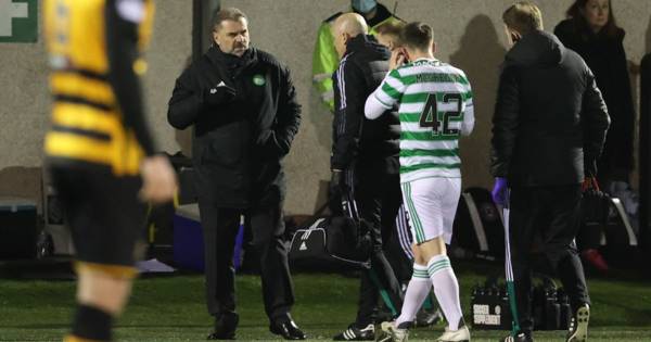 Callum McGregor in Celtic ‘broken bone’ fear as ex-Hoop recalls his own facial injury recovery timeline