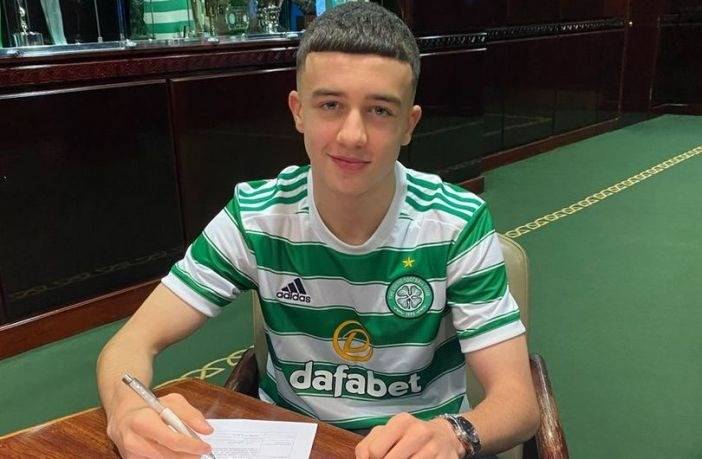 Academy Players under The Celtic Star Spotlight – Jude Bonnar, Under 18 & Celtic B Squad