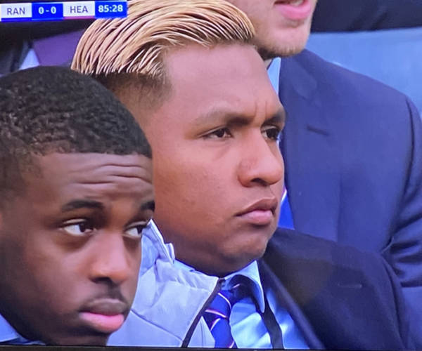 “He’s Ate The Whole Of Seville!” – Fresh Image Of Swollen Faced Morelos Surface From Scottish Cup Final