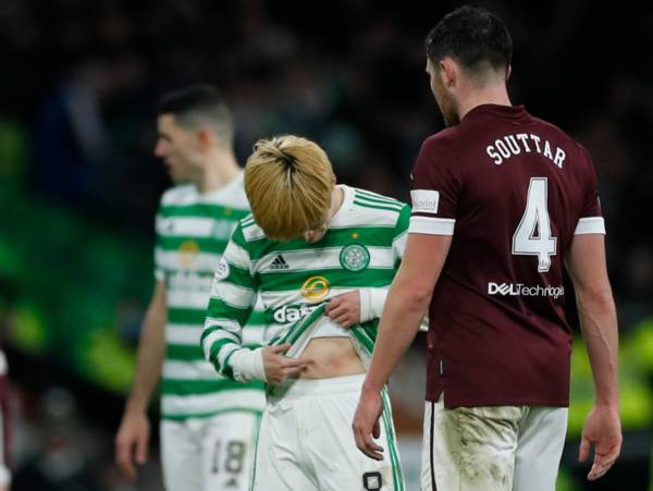 Some buttons pulled out of his ankle- Ibrox agony for Sicknote Souttar