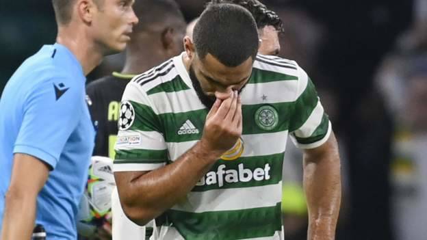 RB Leipzig v Celtic: Defender Cameron Carter-Vickers out for crucial tie