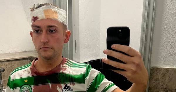 Celtic fan needed stitches and staples in head after ‘unprovoked attack’ from Spanish cops