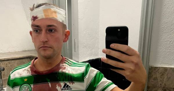 Celtic fan put in hospital by baton wielding Spanish cops in ‘unprovoked attack’