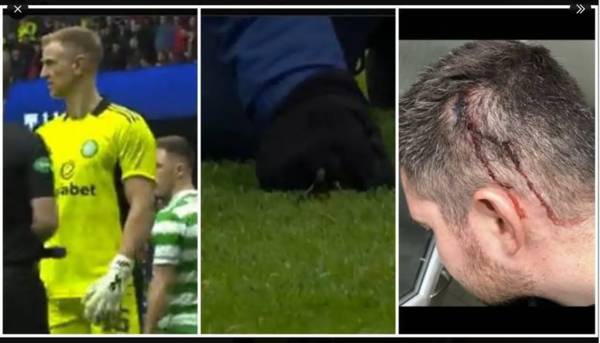 Rangers fan jailed for a year for “mindless violence” against Celtic physio