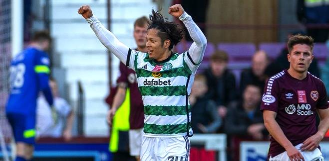 HIBS v CELTIC: 5-MINUTE QUIZ