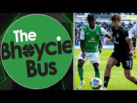 The Celtic Sunday Blether | Squad Depth Deficiences As Celtic Held at Easter Road | Ep. 68