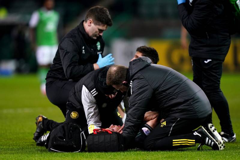 Celtic injury sweat as Alistair Johnston suffers fracture