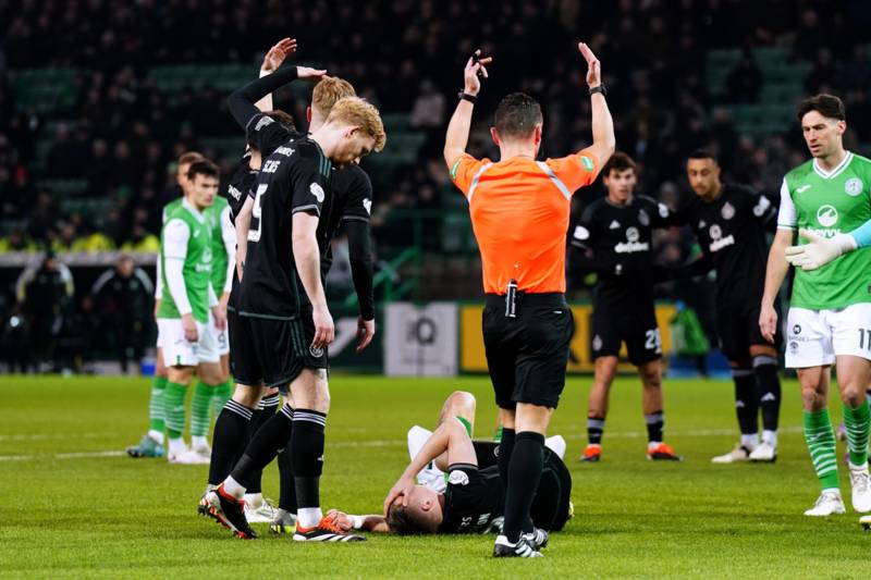 Johnston suffers ‘suspected fracture’ with Celtic head knock