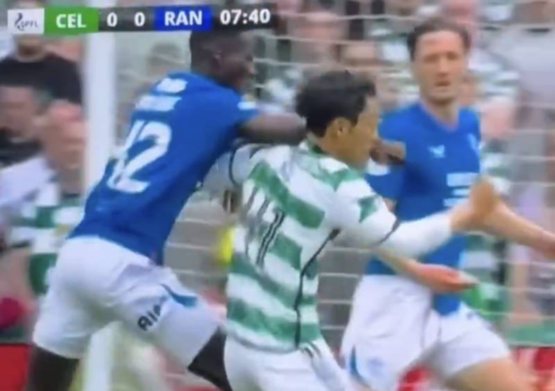 Watch: The Running Elbow Attack On Celtic Player That Was Missed By VAR