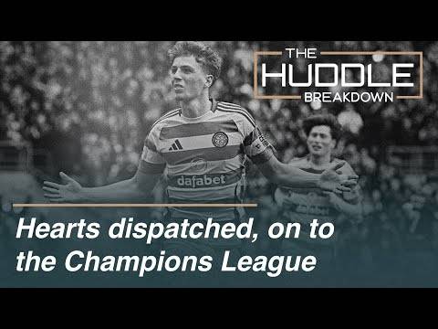 Celtic vs Hearts | Champions League Preview | Accounts