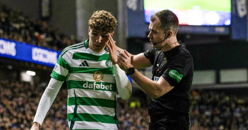 Arne Engels could have lost an eye after Rangers yob missile as Celtic reveal £11m star inches from catastrophe