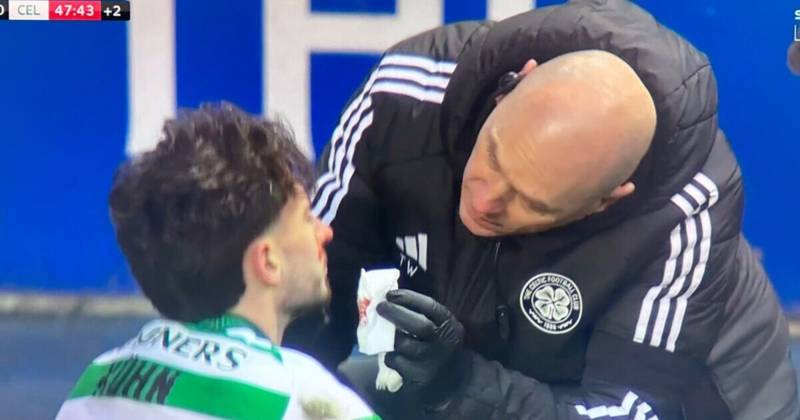 Celtic star left bloodied in O** F*** as Chris Sutton weighs in on ‘nasty’ incident