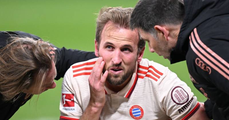 Harry Kane in major Celtic fitness mystery as Bayern Munich boss Vincent Kompany declares ‘I threw up a smoke bomb’