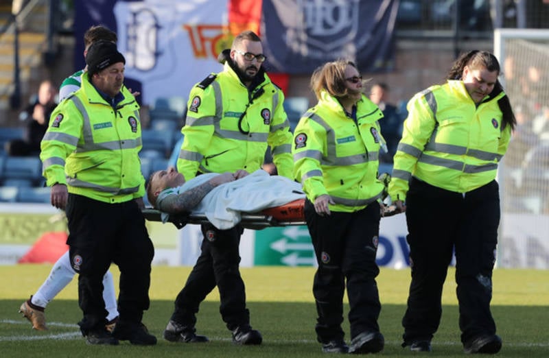 Celtic confirm that Ireland international Hayes has suffered a broken leg