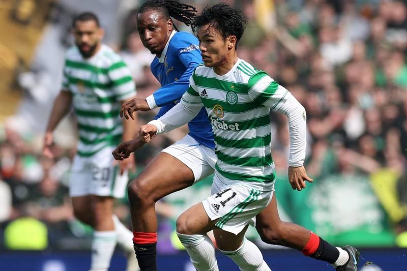 Opinion: Celtic star needs rested, it would do him a world of good