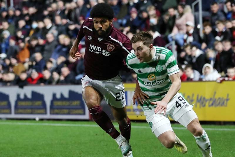 Quiz: How much do you know about James Forrest’s Celtic career?