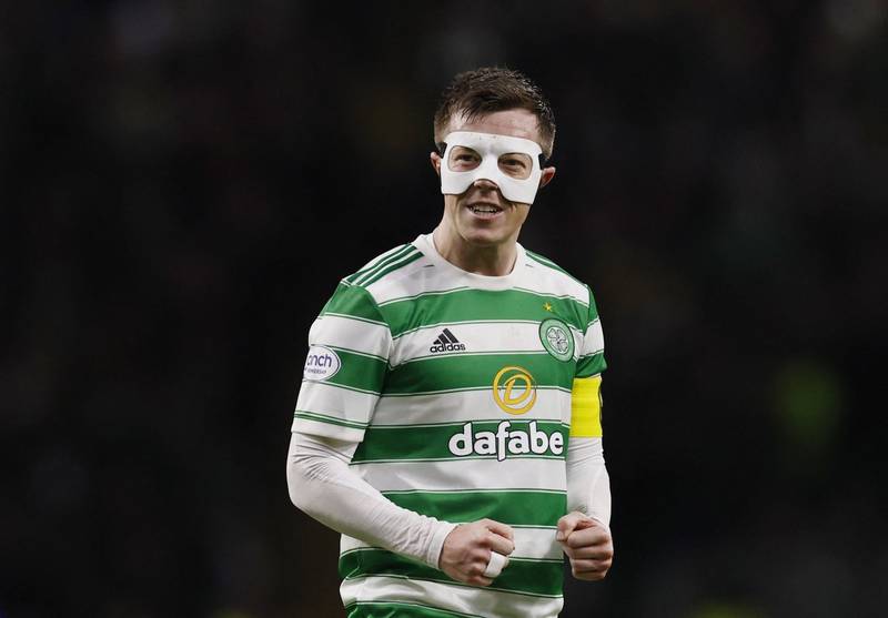 Callum McGregor reveals the secret of the mask