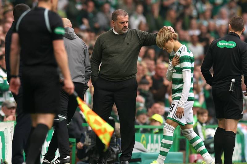 Opinion: Celtic response to massive blow says it all about current side