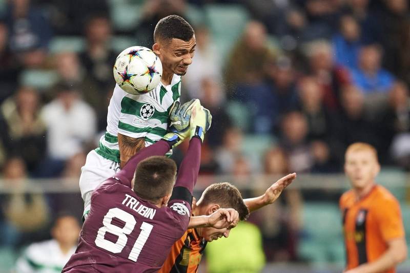 Virals: Celtic will be sweating over availability of injured key player